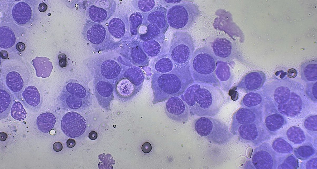 Ser ordenado en oncología: la importancia de la citología en tu clínica